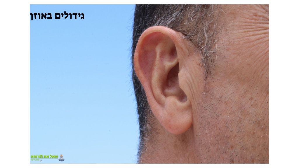 CANVA גידולים באוזן